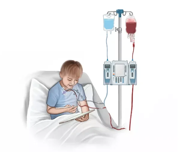 Blood Transfusion