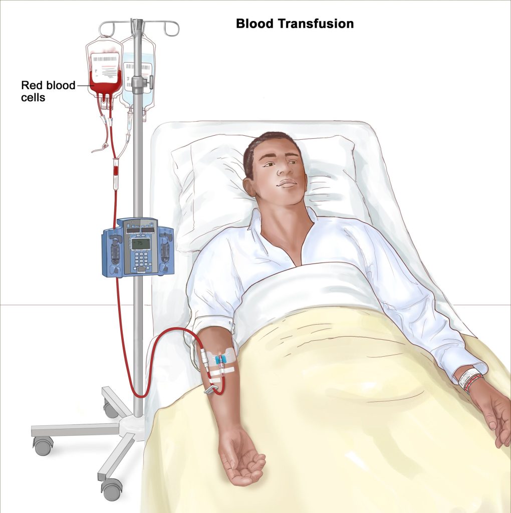 Blood Transfusion