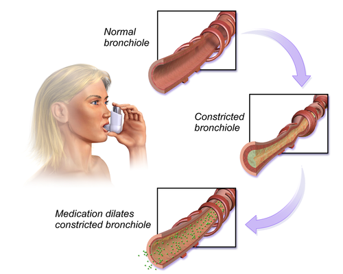 Bronchodilator Therapy